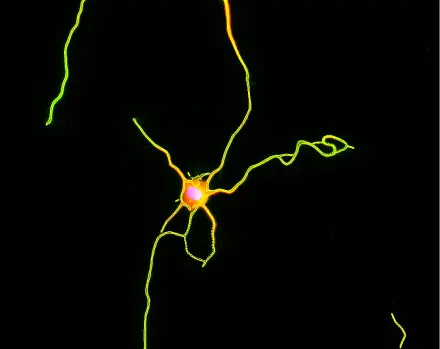 Fluorescent Dendrites