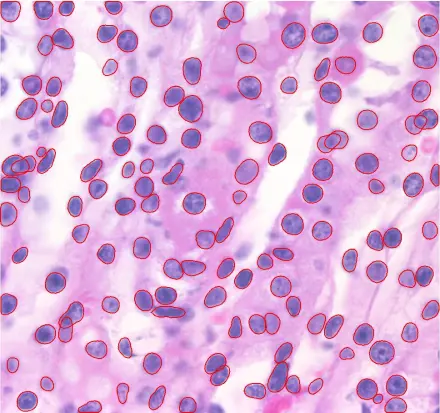 Hematoxylin Nuceli