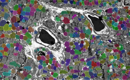TEM Mitochondria
