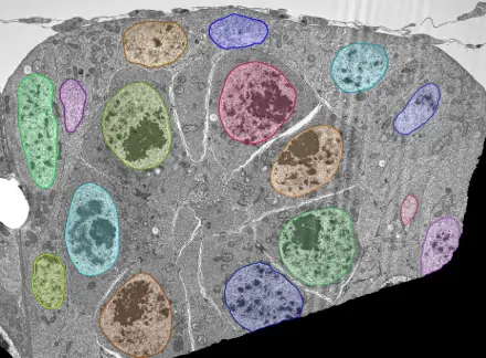 TEM Nuclei