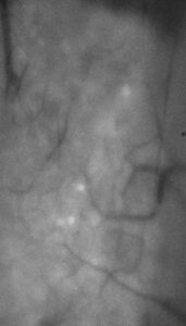 Image acquired without NanoScan OP800