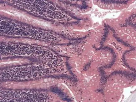Appendix-detail
