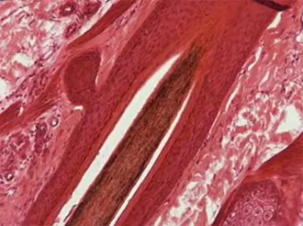 Human-Skin-detail