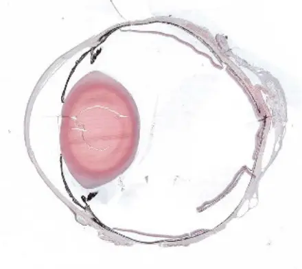 Eye-Section-Smaple