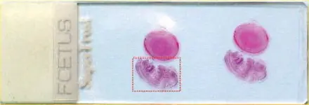 Mouse Foetus-slide