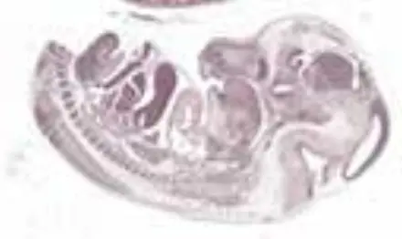 TurboScan-thumb-Mouse-Foetus