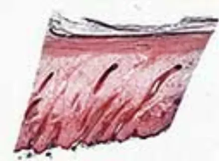 cal6_thumb.jpg